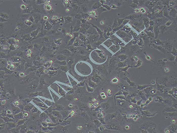 ECC-1人子宫内膜癌细胞（Ishikawa 3-H-12污染细胞系）