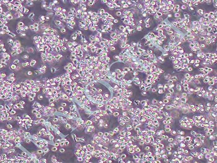 6T-CEM人T细胞白血病细胞（STR鉴定正确）