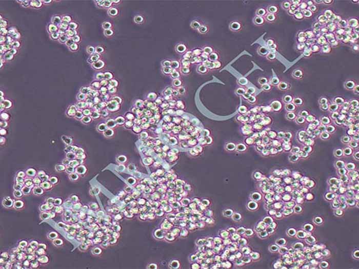 SNU-1人胃癌细胞（STR鉴定正确）
