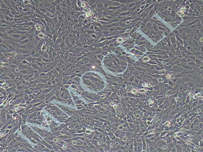 CTX-TNA2大鼠脑I型星形胶质细胞