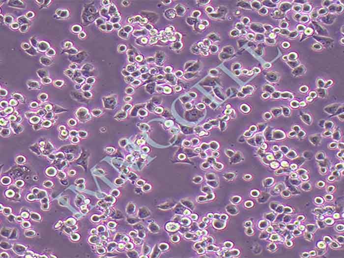 neuro-2a（N2A）小鼠脑神经瘤细胞（STR鉴定正确）