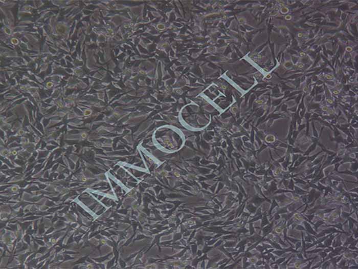 RM-1小鼠前列腺癌细胞