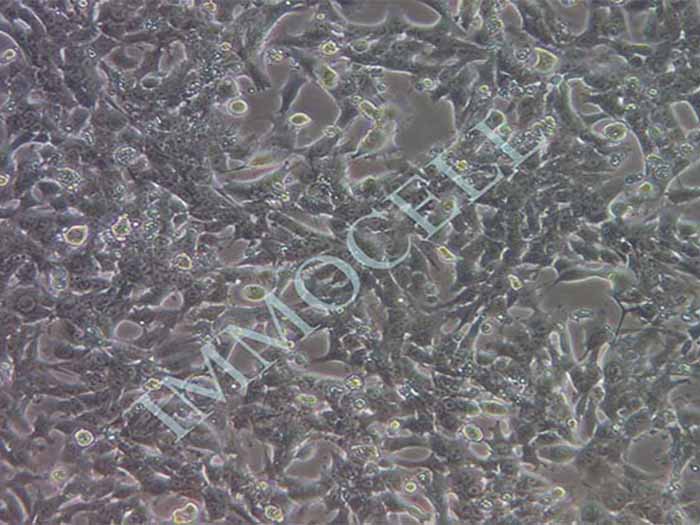 hepa1-6小鼠肝癌细胞