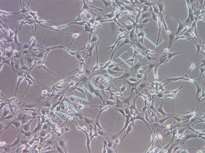 3T3-L1小鼠胚胎成纤维细胞（STR鉴定正确）