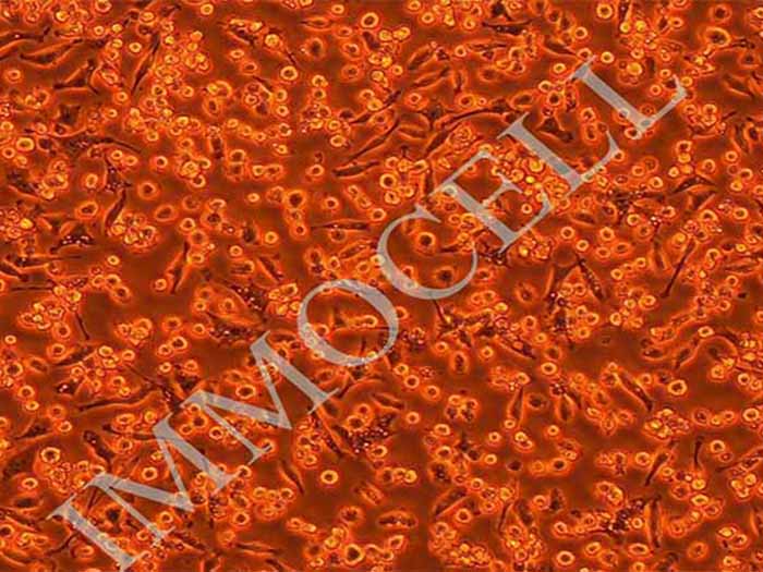 NCTC1469小鼠正常肝细胞