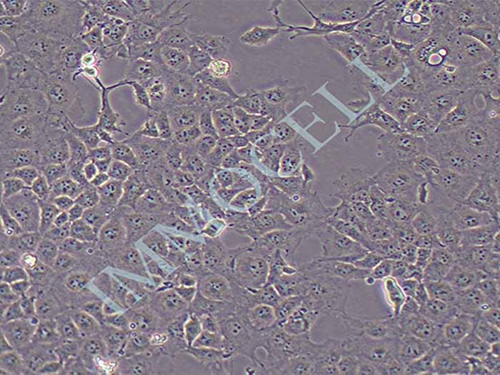 COS-7非洲绿猴SV40转化的肾细胞