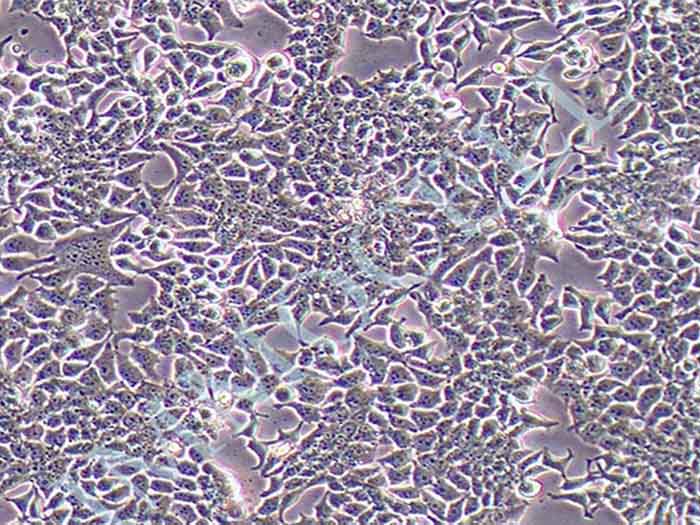 PC3-FLUC-puro人前列腺癌细胞(FLUC标记)