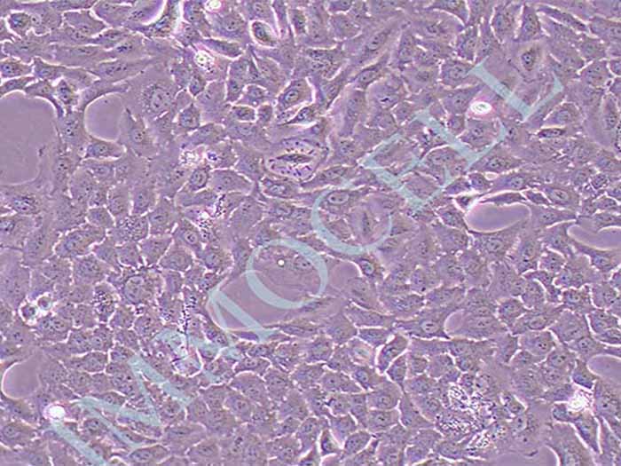 A549/DDP人非小细胞肺癌细胞顺铂耐药株（STR鉴定正确）