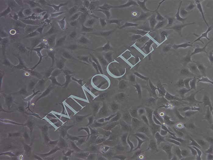 SKOV3-FLUC-bsd人卵巢癌细胞(FLUC标记)