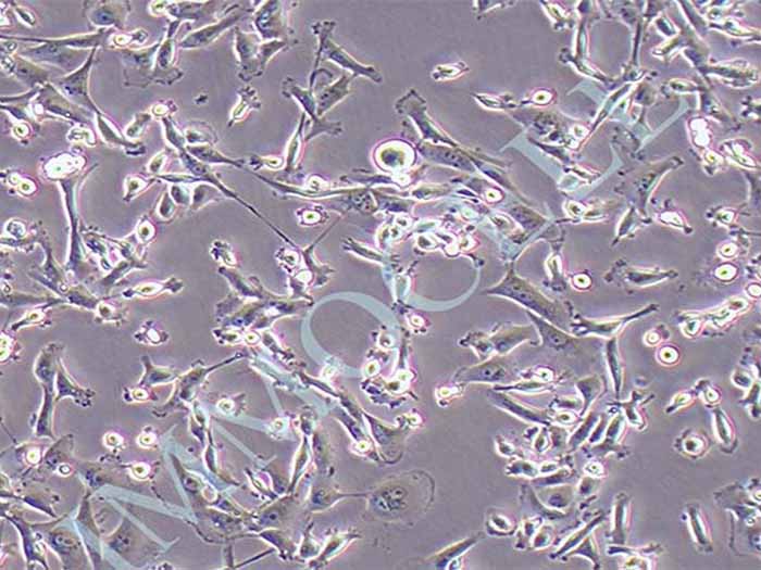 MDA-MB-231-FLUC-puro人三阴性乳腺癌(FLUC标记)