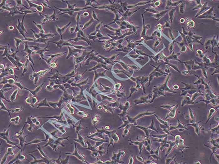 22RV1-FLUC-puro人前列腺癌细胞(FLUC标记)（暂不出售）