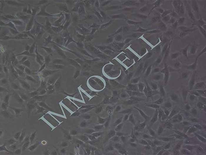 TPC-1人乳头瘤状甲状腺癌细胞（STR鉴定正确）