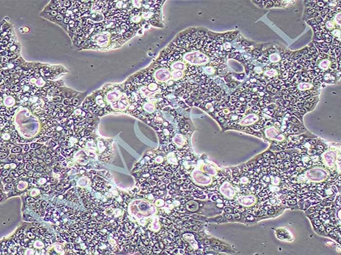 NCI-N87人胃癌细胞（STR鉴定正确）