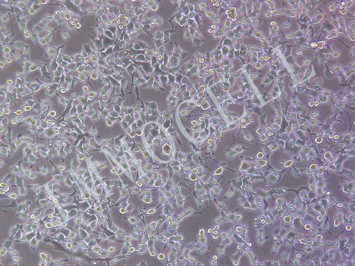 MFC-FLUC-puro小鼠前胃癌细胞(FLUC标记)