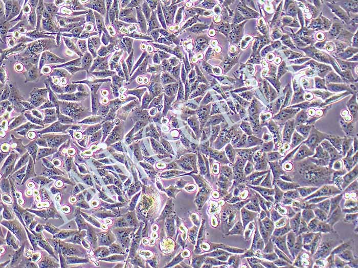 A375-eGFP-puro人恶性黑色素瘤细胞(eGFP标记)