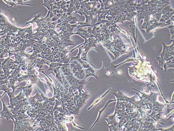 U87MG-RFP-puro人脑星形胶质母细胞瘤(RFP标记)