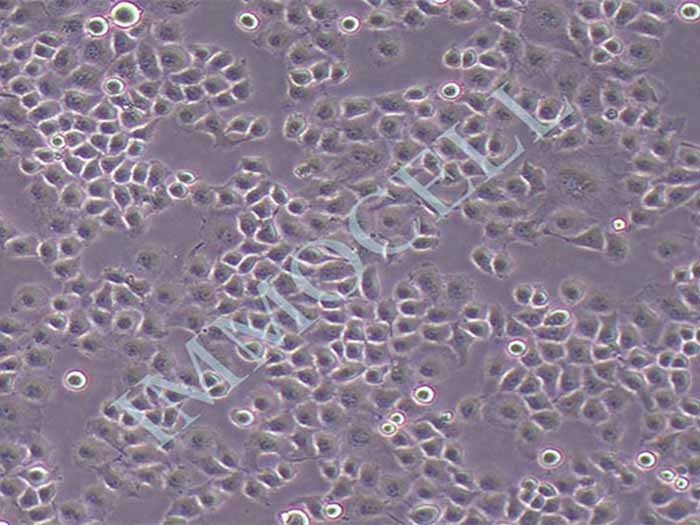 HO-8910PM-FLUC-puro人卵巢癌细胞(FLUC标记)