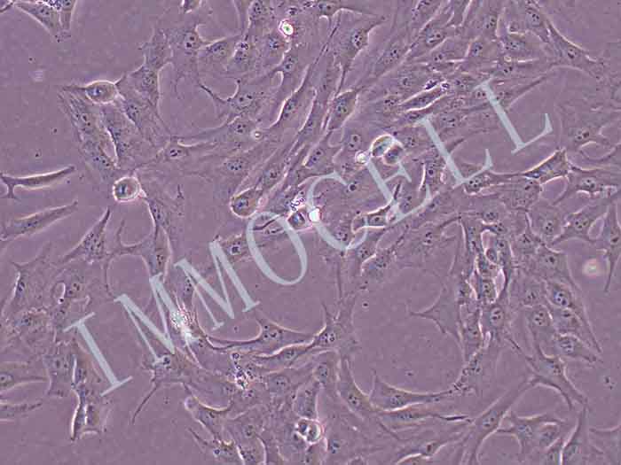 MG-63人骨肉瘤细胞（STR鉴定正确）