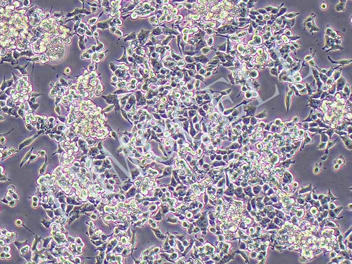 MKN-45-FLUC-puro人胃癌细胞(FLUC标记)