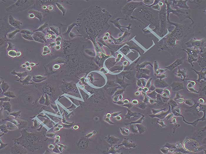 SK-BR-3-FLUC-puro人乳腺癌细胞(FLUC标记)