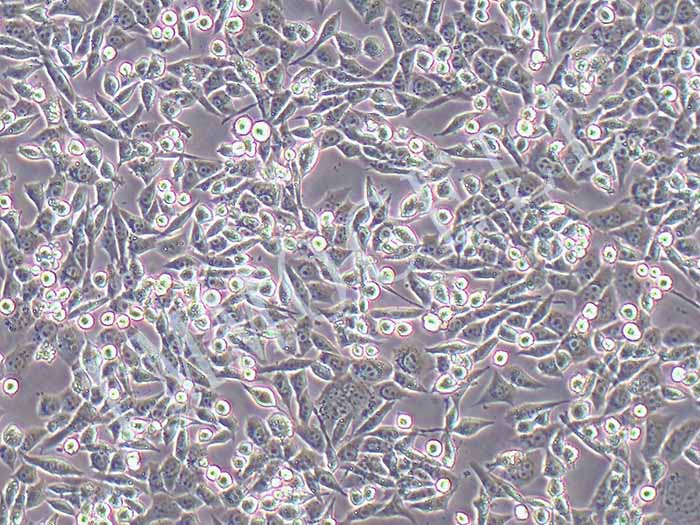 LLC-FLUC-puro小鼠Lewis肺癌细胞(FLUC标记)