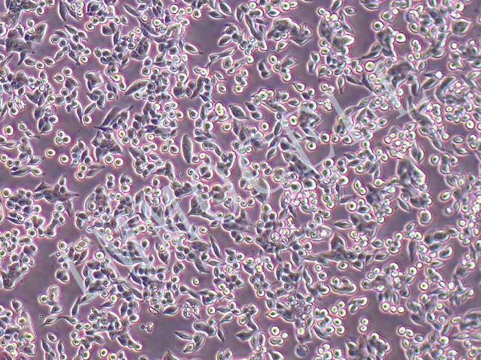 SW620-FLUC-puro人结直肠腺癌细胞(FLUC标记)