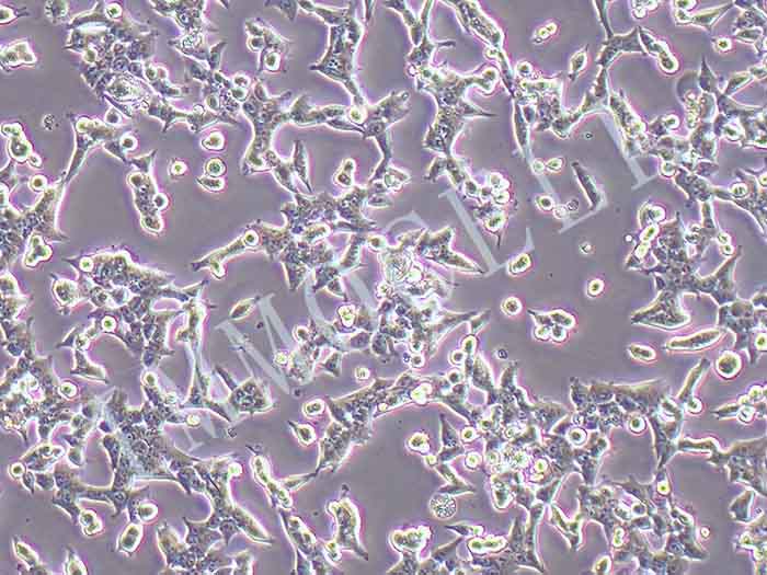 HCT116-FLUC-puro人结肠腺癌细胞(FLUC标记)