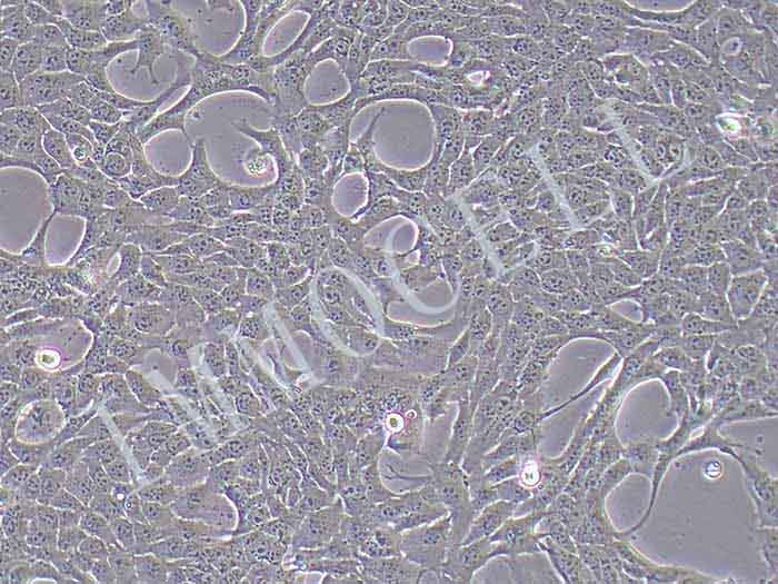 T47D-FLUC-puro人乳腺癌细胞(FLUC标记)